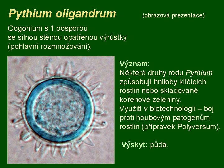 Pythium oligandrum (obrazová prezentace) Oogonium s 1 oosporou se silnou stěnou opatřenou výrůstky (pohlavní