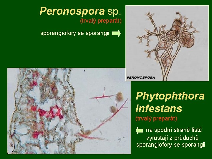 Peronospora sp. (trvalý preparát) sporangiofory se sporangii Phytophthora infestans (trvalý preparát) na spodní straně
