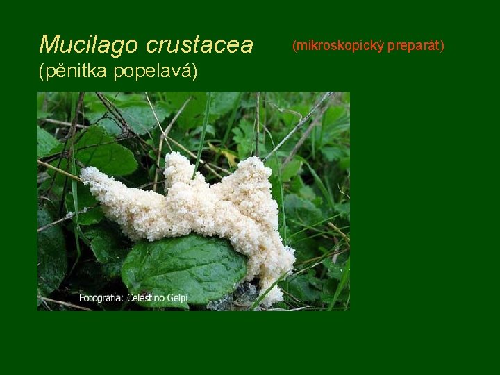 Mucilago crustacea (pěnitka popelavá) (mikroskopický preparát) 