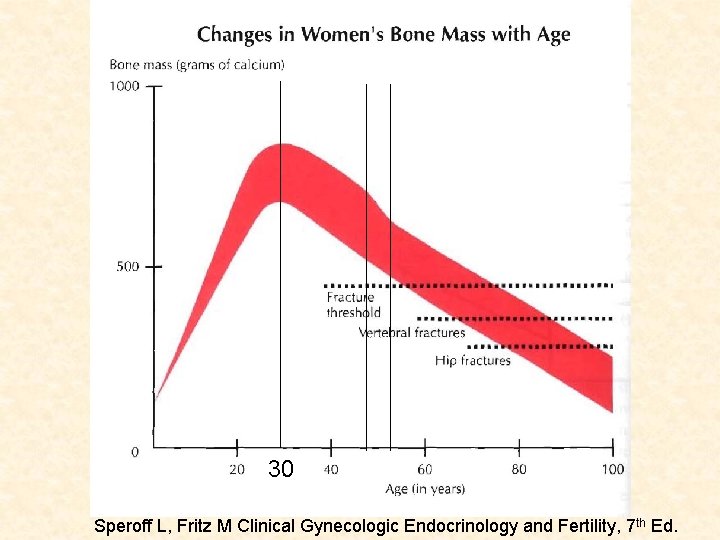 30 Speroff L, Fritz M Clinical Gynecologic Endocrinology and Fertility, 7 th Ed. 