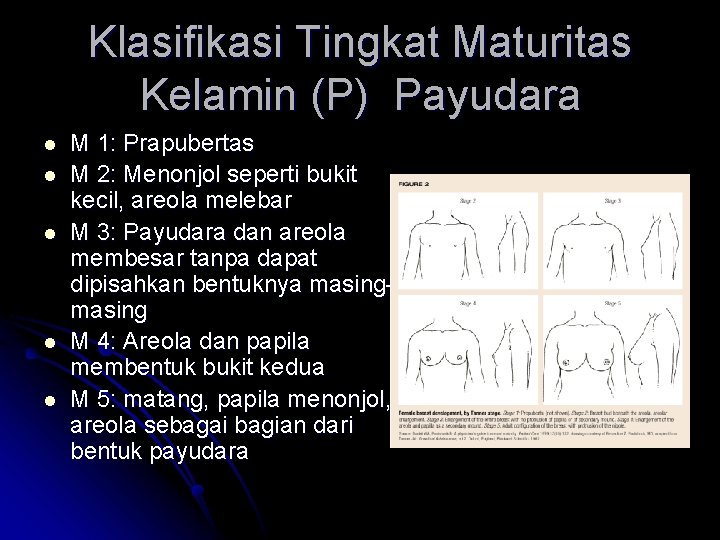 Klasifikasi Tingkat Maturitas Kelamin (P) Payudara l l l M 1: Prapubertas M 2: