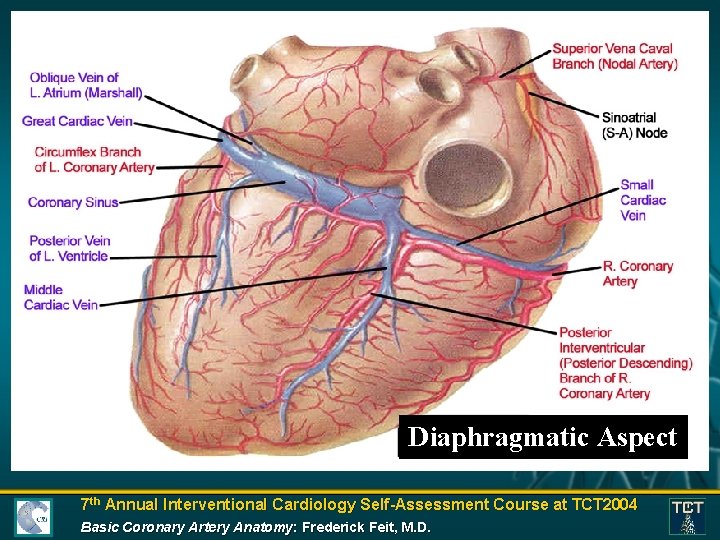 Diaphragmatic Aspect 7 th Annual Interventional Cardiology Self-Assessment Course at TCT 2004 Basic Coronary