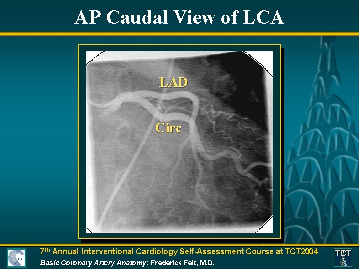 AP Caudal View of LCA LAD Circ 7 th Annual Interventional Cardiology Self-Assessment Course