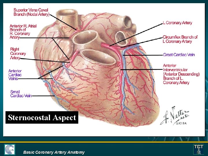 Sternocostal Aspect Basic Coronary Artery Anatomy 