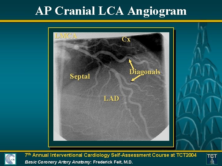 AP Cranial LCA Angiogram LMCA Cx Diagonals Septal LAD 7 th Annual Interventional Cardiology