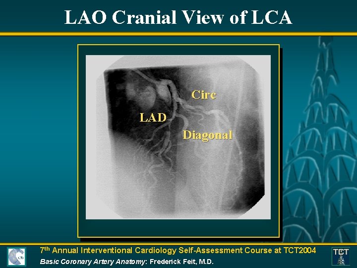 LAO Cranial View of LCA Circ LAD Diagonal 7 th Annual Interventional Cardiology Self-Assessment