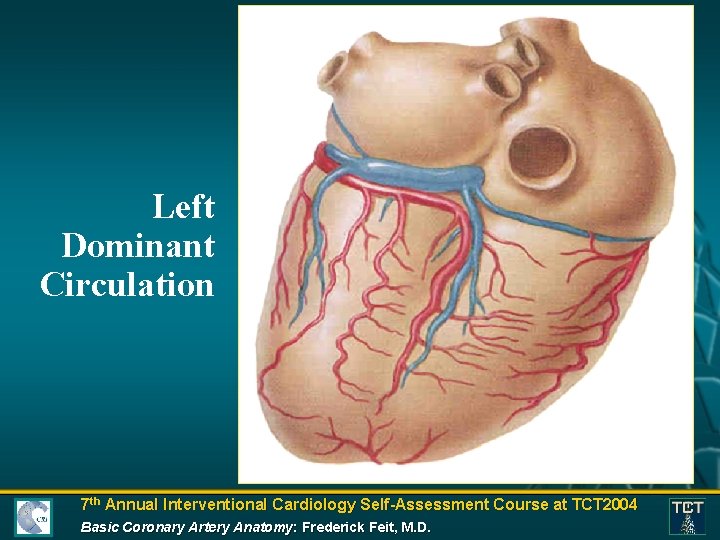 Left Dominant Circulation 7 th Annual Interventional Cardiology Self-Assessment Course at TCT 2004 Basic