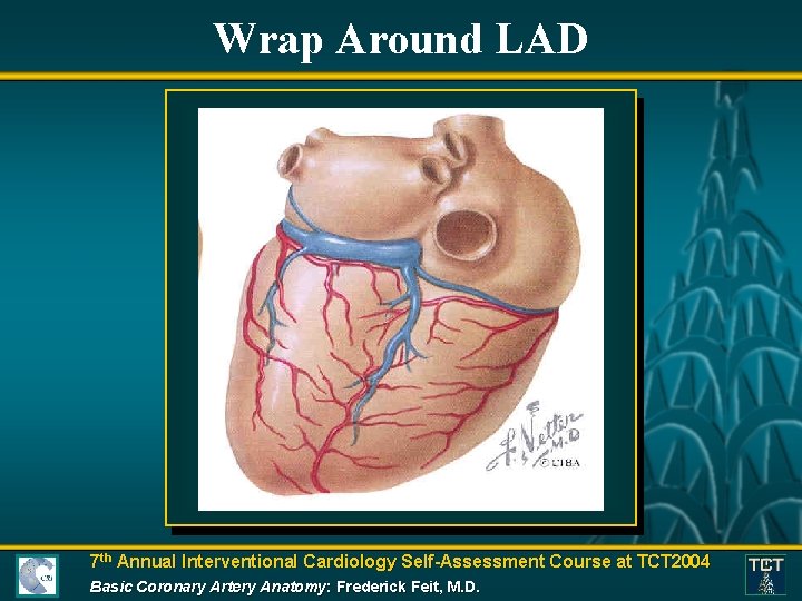 Wrap Around LAD 7 th Annual Interventional Cardiology Self-Assessment Course at TCT 2004 Basic