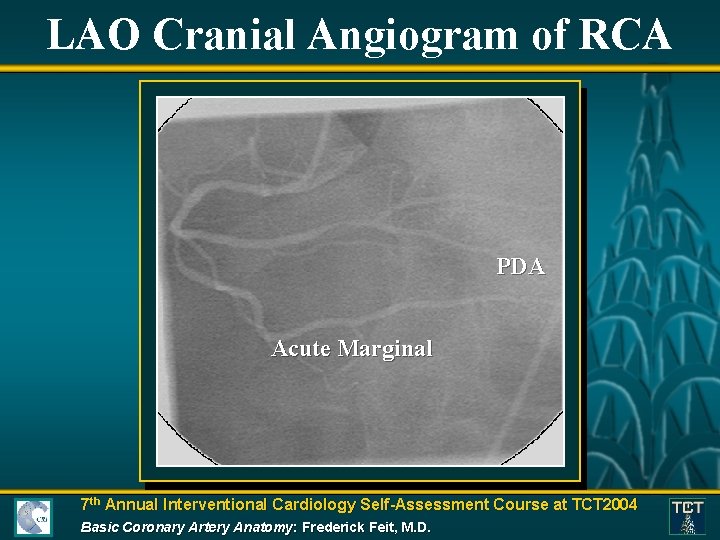 LAO Cranial Angiogram of RCA PDA Acute Marginal 7 th Annual Interventional Cardiology Self-Assessment