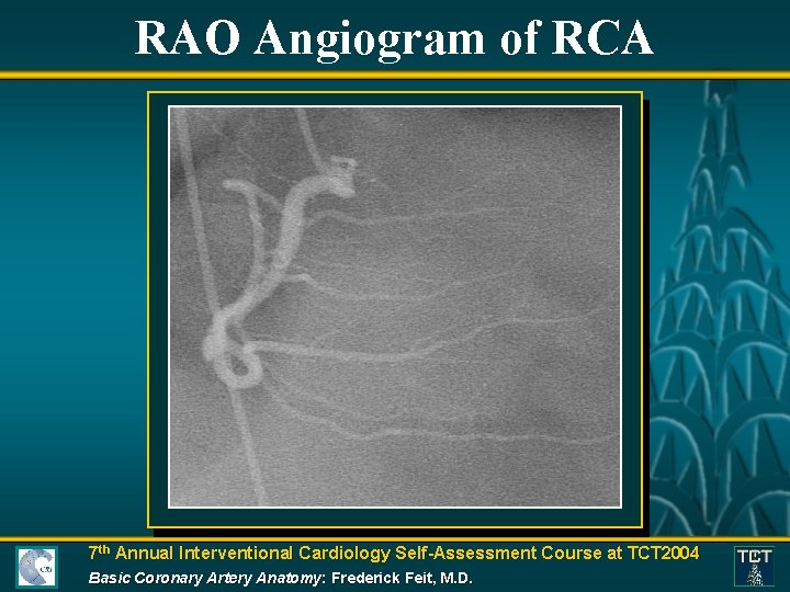 RAO Angiogram of RCA 7 th Annual Interventional Cardiology Self-Assessment Course at TCT 2004