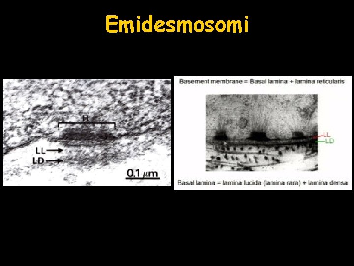 Emidesmosomi 