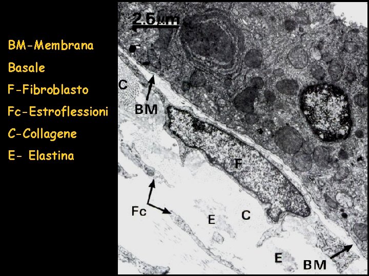 BM-Membrana Basale F-Fibroblasto Fc-Estroflessioni C-Collagene E- Elastina 