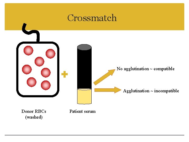 Crossmatch No agglutination ~ compatible Agglutination ~ incompatible Donor RBCs (washed) Patient serum 