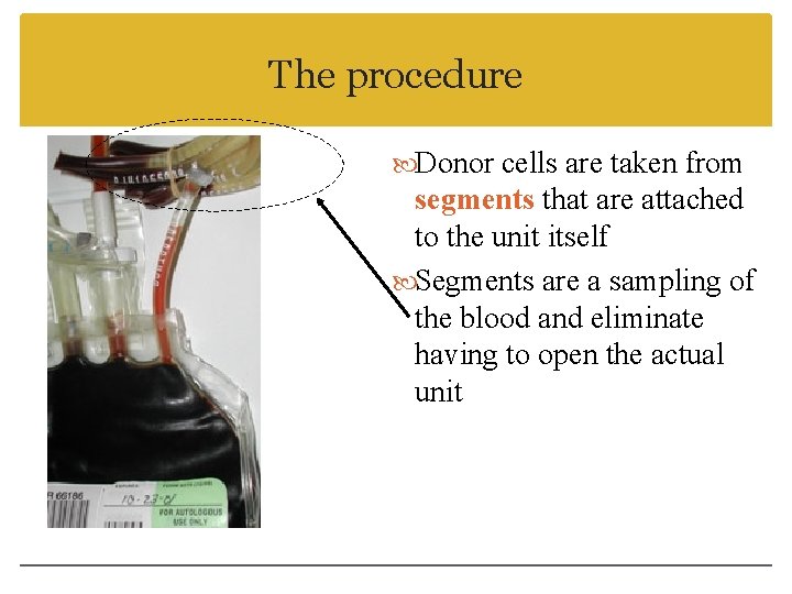 The procedure Donor cells are taken from segments that are attached to the unit