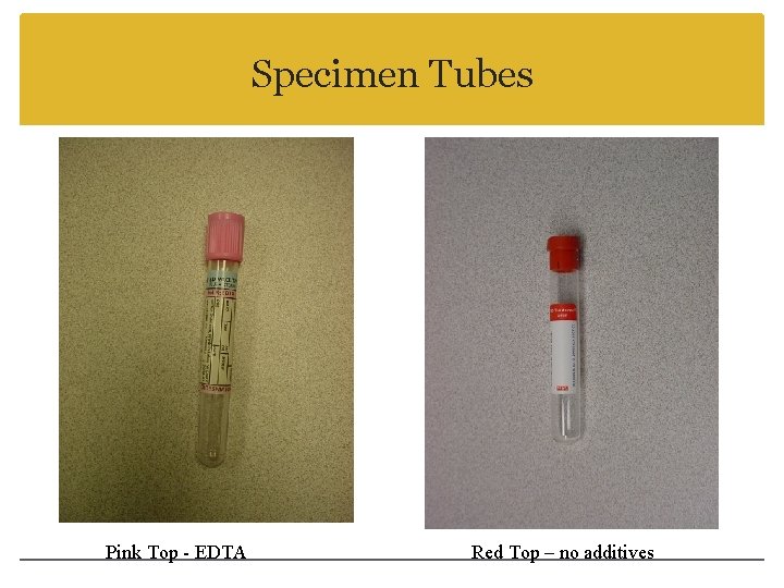 Specimen Tubes Pink Top - EDTA Red Top – no additives 