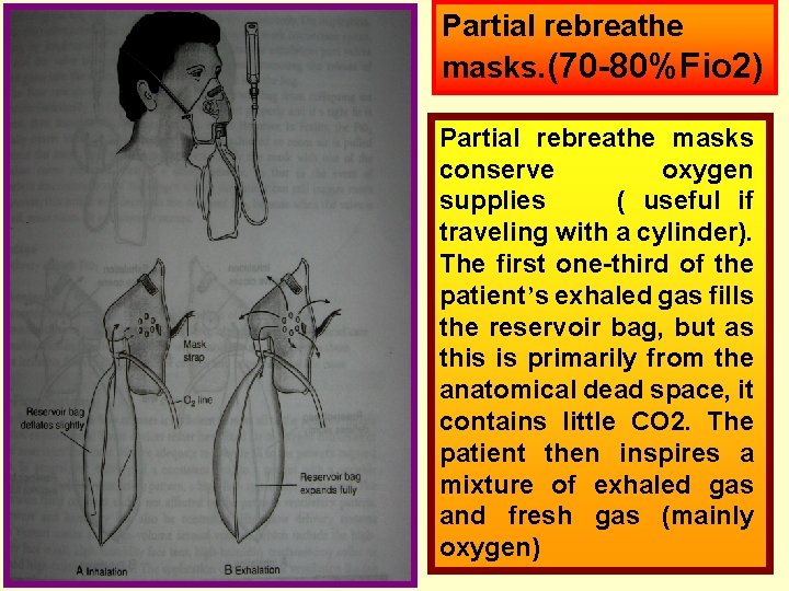 Partial rebreathe masks. (70 -80%Fio 2) Partial rebreathe masks conserve oxygen supplies ( useful