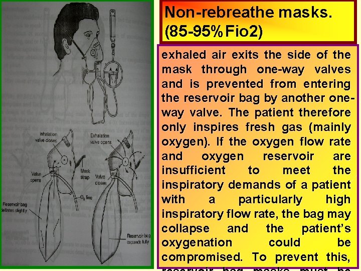 Non-rebreathe masks. (85 -95%Fio 2) exhaled air exits the side of the mask through