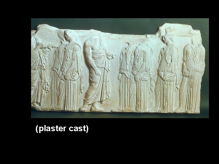 (plaster cast) 