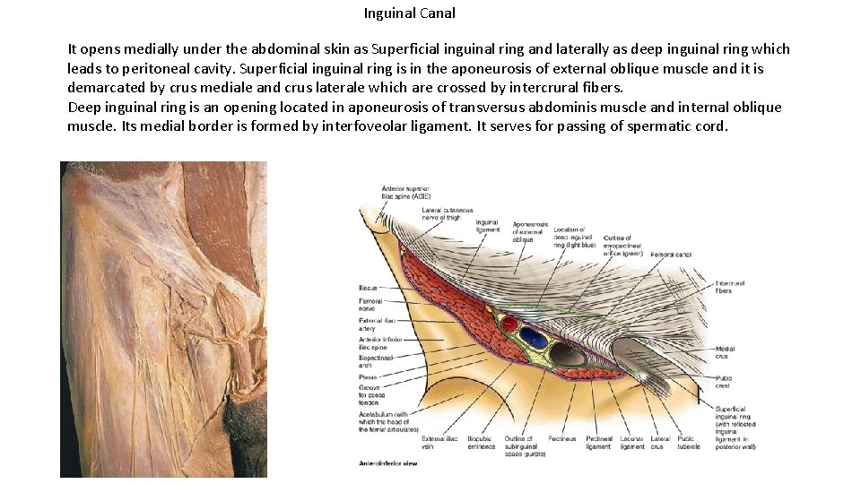 Inguinal Canal It opens medially under the abdominal skin as Superficial inguinal ring and