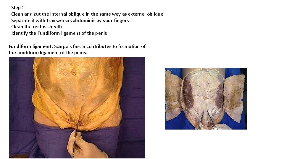 Step 5 Clean and cut the internal oblique in the same way as external