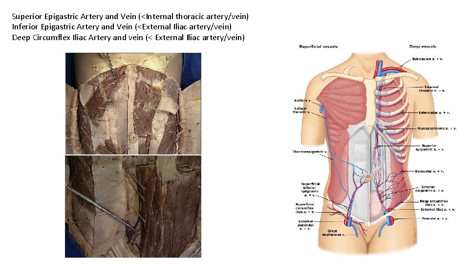 Superior Epigastric Artery and Vein (<Internal thoracic artery/vein) Inferior Epigastric Artery and Vein (<External