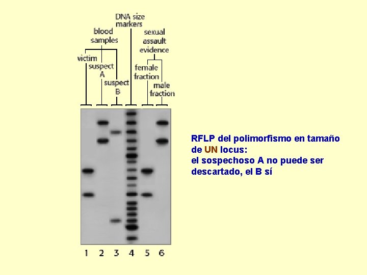 RFLP del polimorfismo en tamaño de UN locus: el sospechoso A no puede ser