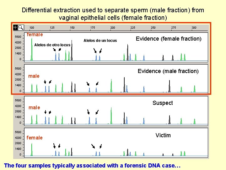 Differential extraction used to separate sperm (male fraction) from vaginal epithelial cells (female fraction)