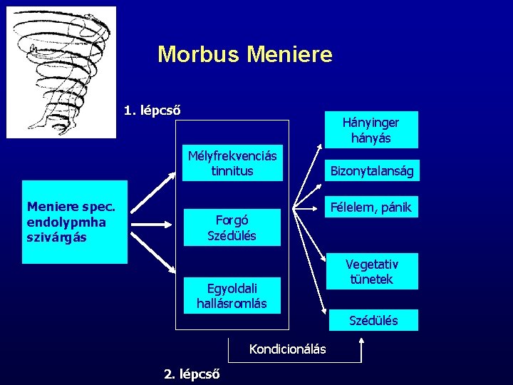 Morbus Meniere 1. lépcső Hányinger hányás Mélyfrekvenciás tinnitus Meniere spec. endolypmha szivárgás Forgó Szédülés