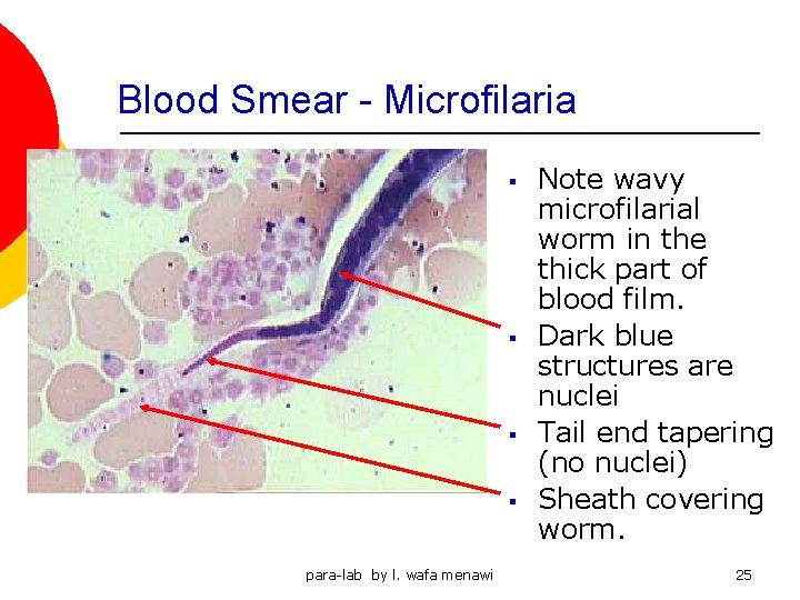 Blood Smear - Microfilaria § § para-lab by l. wafa menawi Note wavy microfilarial