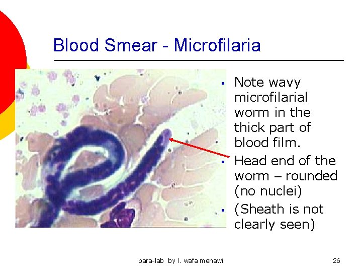 Blood Smear - Microfilaria § § § para-lab by l. wafa menawi Note wavy