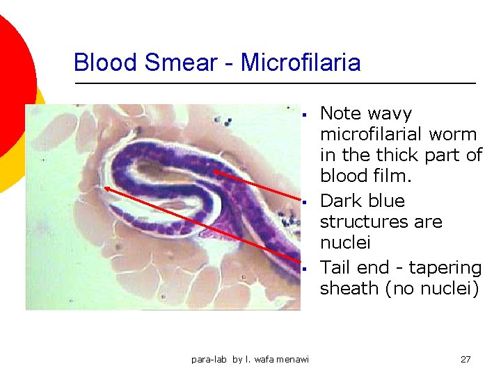 Blood Smear - Microfilaria § § § para-lab by l. wafa menawi Note wavy