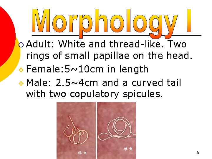 ¡ Adult: White and thread-like. Two rings of small papillae on the head. v