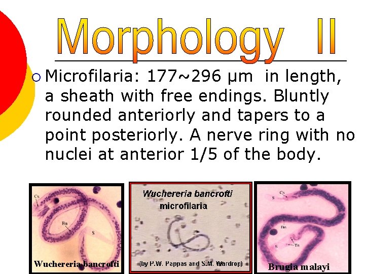 ¡ Microfilaria: 177~296 µm in length, a sheath with free endings. Bluntly rounded anteriorly