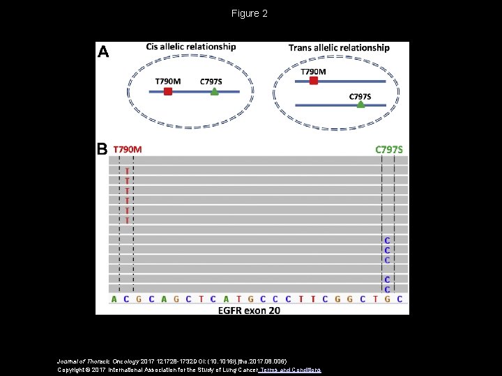 Figure 2 Journal of Thoracic Oncology 2017 121728 -1732 DOI: (10. 1016/j. jtho. 2017.