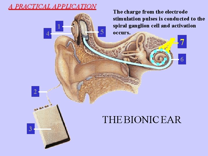 A PRACTICAL APPLICATION 4 1 5 The charge from the electrode stimulation pulses is