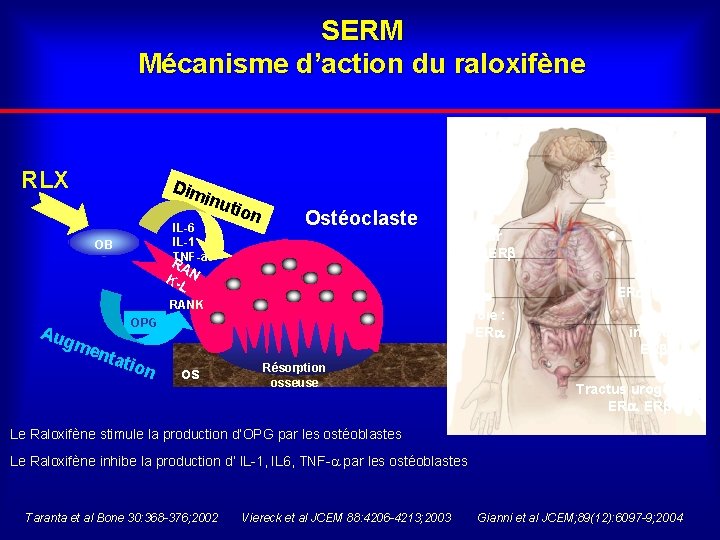 SERM Mécanisme d’action du raloxifène SNC ER , ER RLX Dim inu IL-6 IL-1