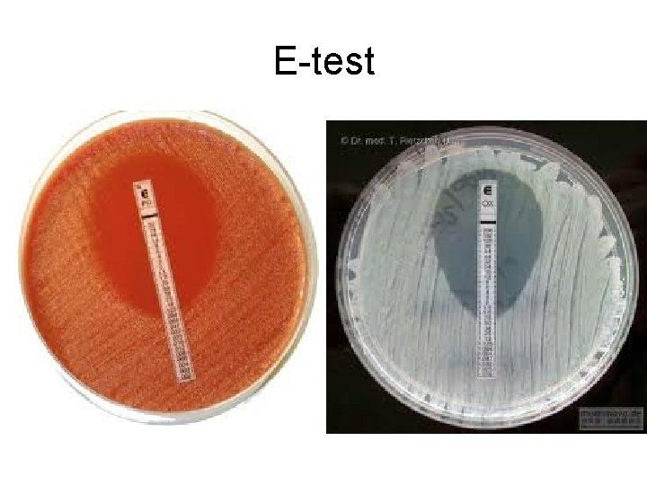 E-test 