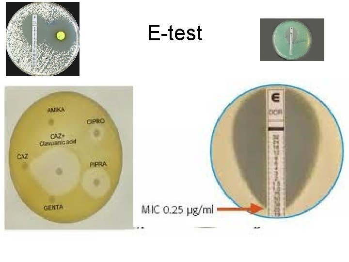 E-test 