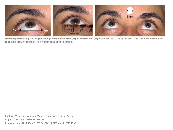 Landgraf, Mirjam N. ; Nothacker, Monika; Kopp, Ina B. ; Heinen, Florian Diagnose des
