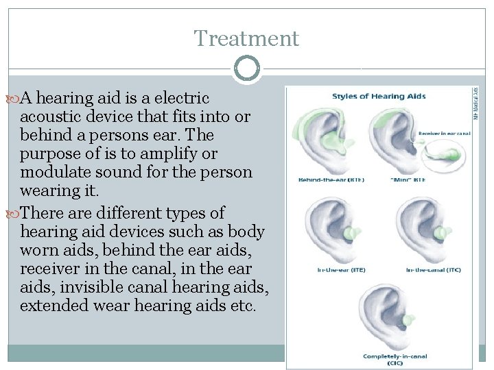 Treatment A hearing aid is a electric acoustic device that fits into or behind