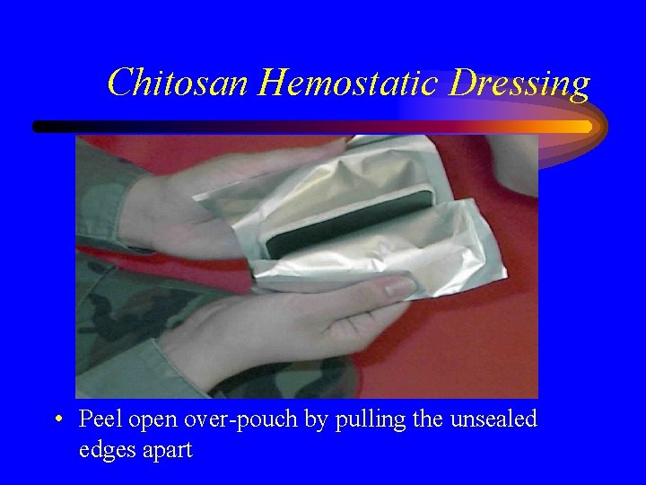 Chitosan Hemostatic Dressing • Peel open over-pouch by pulling the unsealed edges apart 