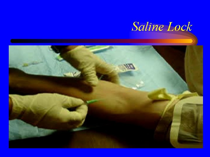 Saline Lock 