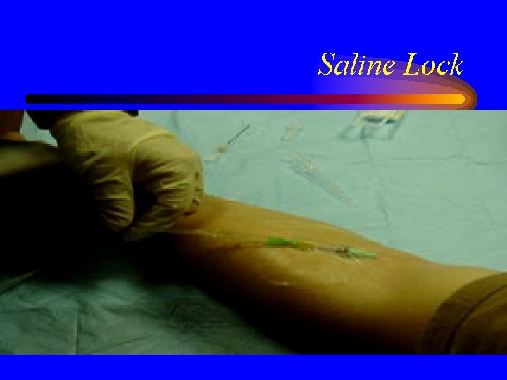 Saline Lock 