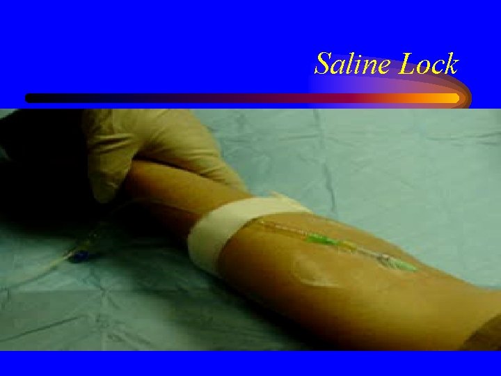 Saline Lock 