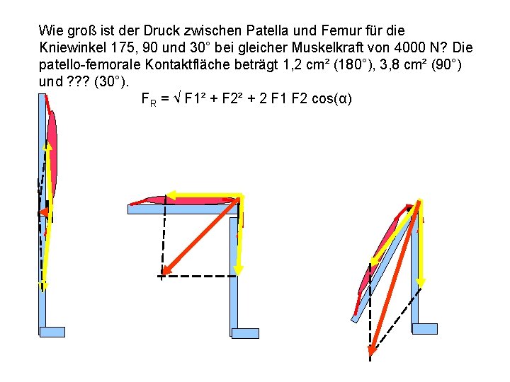 Wie groß ist der Druck zwischen Patella und Femur für die Kniewinkel 175, 90