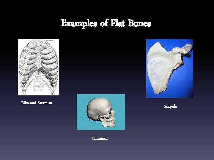 Examples of Flat Bones Ribs and Sternum Scapula Cranium 