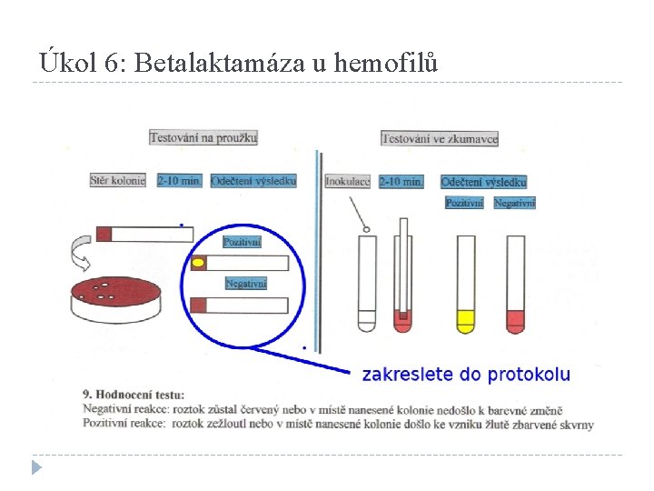 Úkol 6: Betalaktamáza u hemofilů 
