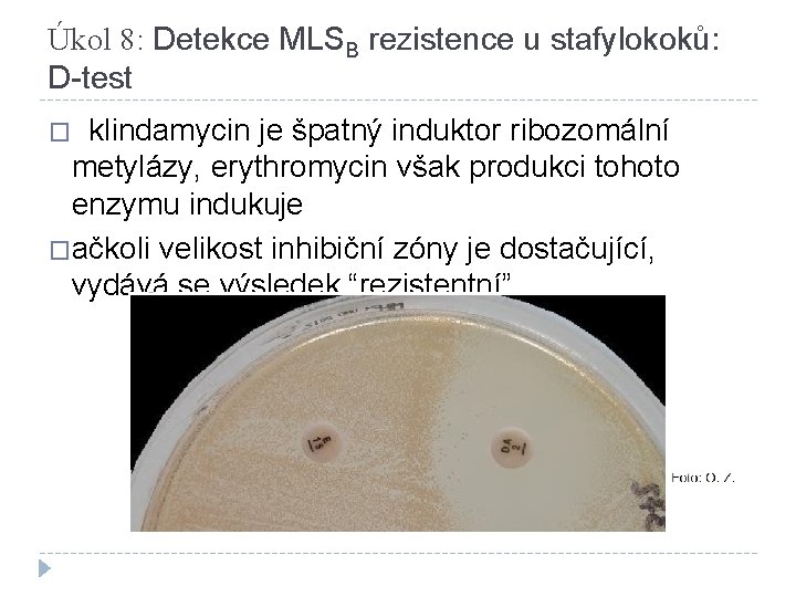 Úkol 8: Detekce MLSB rezistence u stafylokoků: D-test klindamycin je špatný induktor ribozomální metylázy,