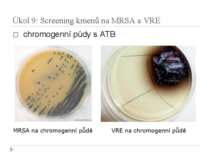 Úkol 9: Screening kmenů na MRSA a VRE � chromogenní půdy s ATB 