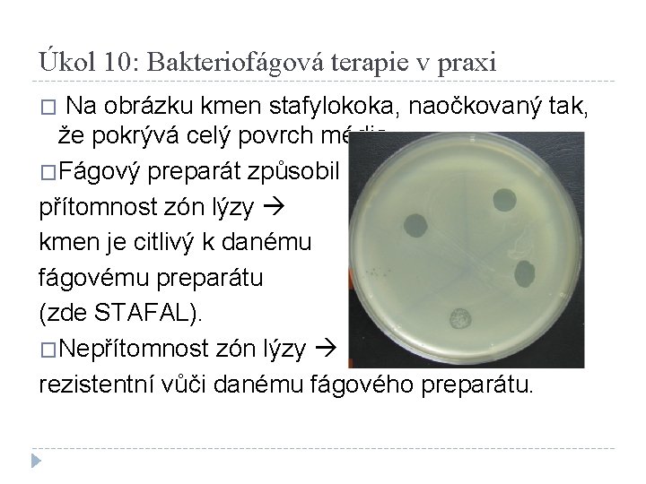 Úkol 10: Bakteriofágová terapie v praxi Na obrázku kmen stafylokoka, naočkovaný tak, že pokrývá